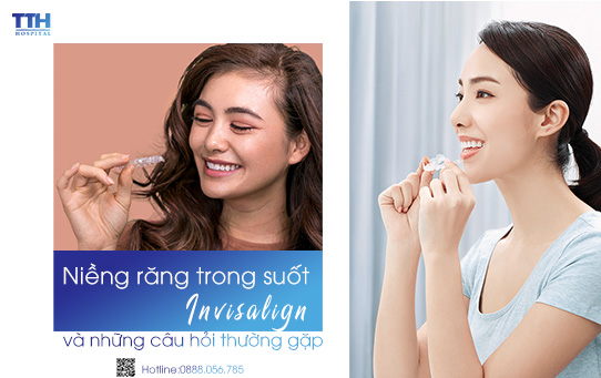 Những câu hỏi thường gặp về Invisalign - Niềng răng trong suốt tại Nghệ An